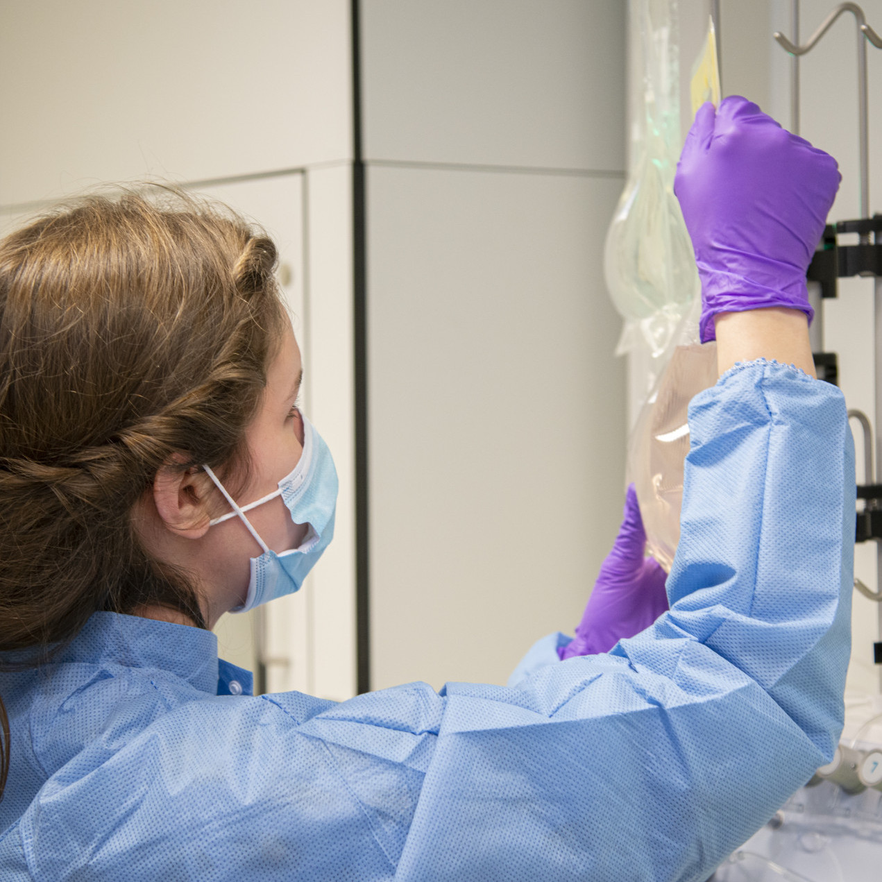 Children with leukemia treated with innovative CAR-T therapy